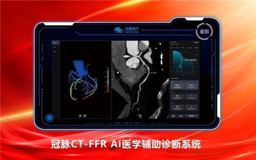一月三证，i深睿医疗冠脉CT-FFR产品获NMPA三类证，巩固I类医疗器械地位